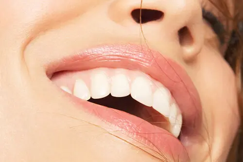 country club dental teeth whitening - close up of smiling teeth