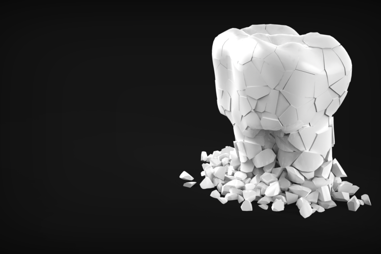 emergency dentist flagstaff - tooth broken