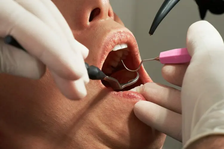 dental assistant