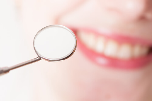 country club dentist teeth cleaning flagstaff - close up of dental mirror in front of a mouth