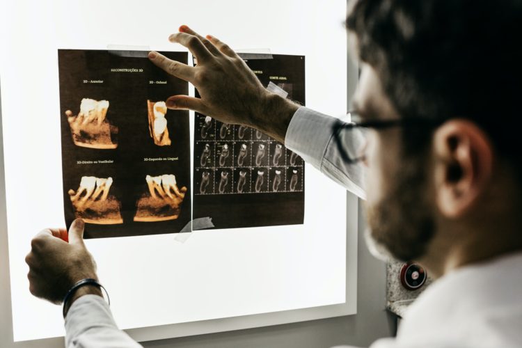 dentist looking at xray leading causes of tooth decay