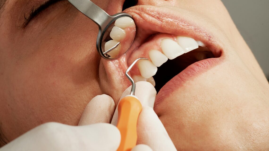 woman getting dental scaling -treatment for gum disease