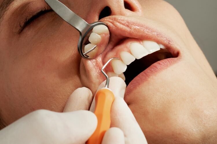 woman getting dental scaling -treatment for gum disease