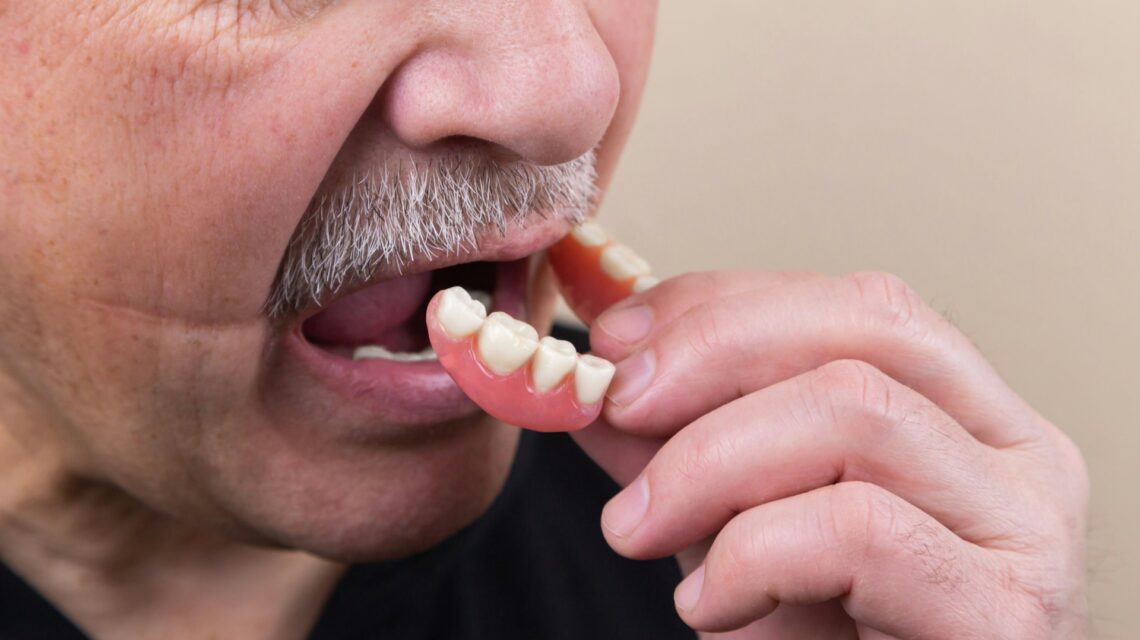Man putting in a partial - is cleaning dentures important