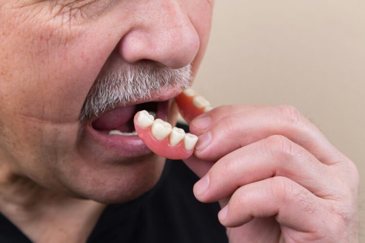 Man putting in a partial - is cleaning dentures important