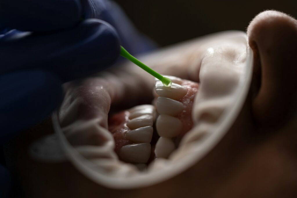 tooth undergoing procedure - what are dental veneers