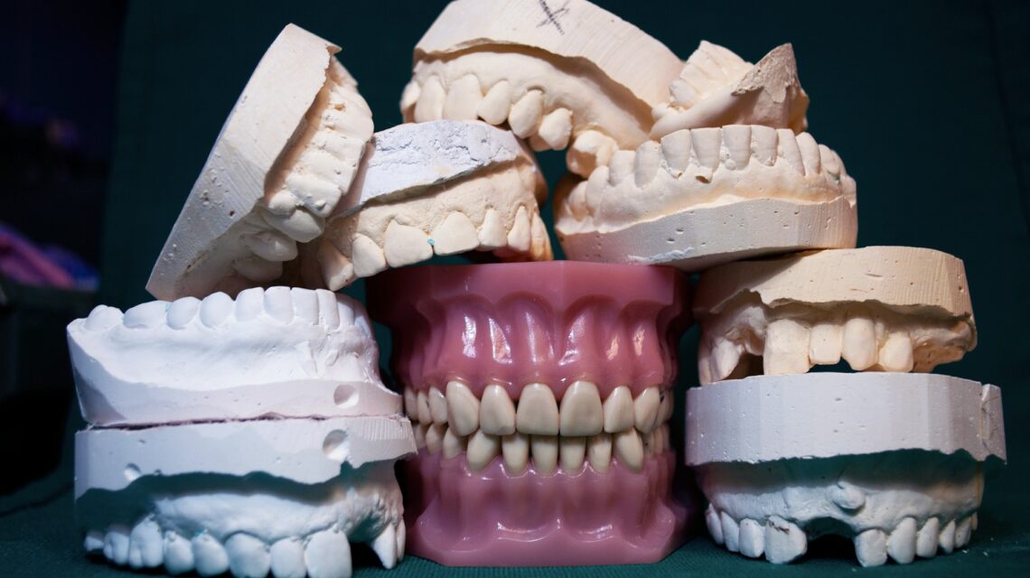 dentures and molds - getting used to dentures