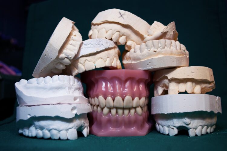 dentures and molds - getting used to dentures