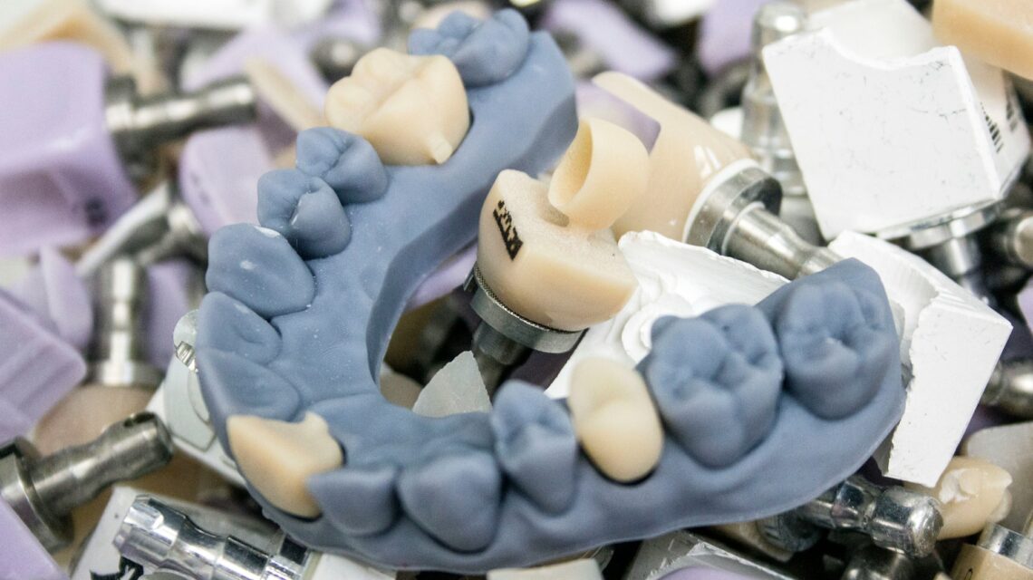 making a dental crown - caring for a dental crown